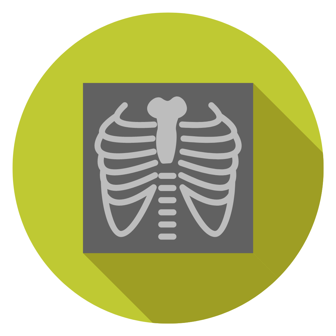 X-Ray